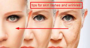 Important tips for getting rid of skin rashes and wrinkles